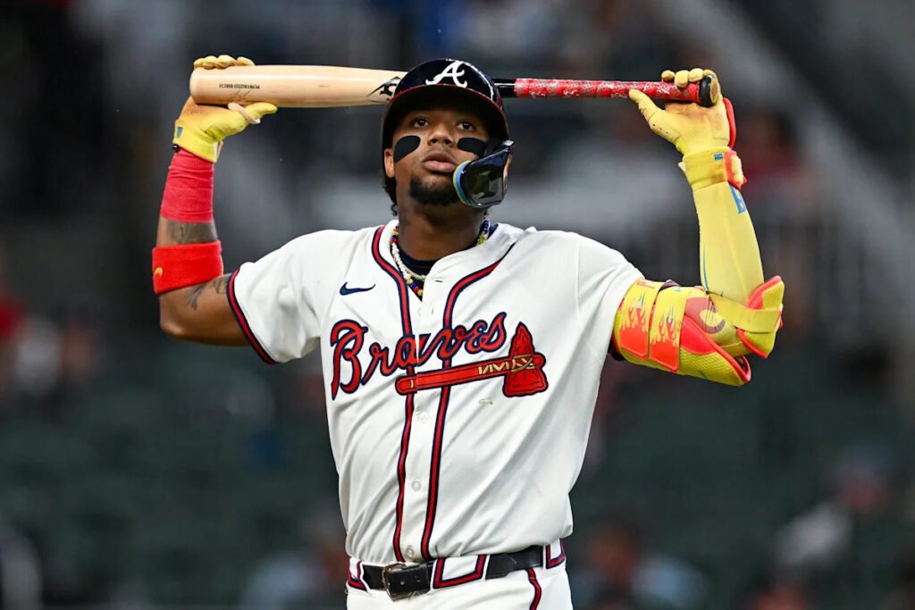 Ronald-Acuna-Jr.-fuera-de-juego-por-lesion-en-el-tendon-de-Aquiles_.jpg